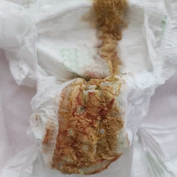 Aptamil Bebek Maması