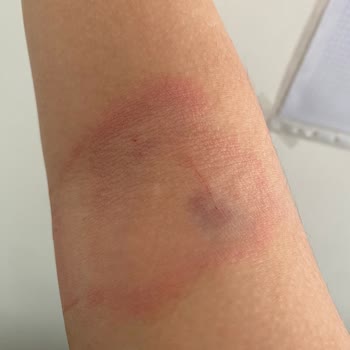 İzmir Bayraklı Şehir Hastanesi Kan Alma Ve Doktor Kabusu