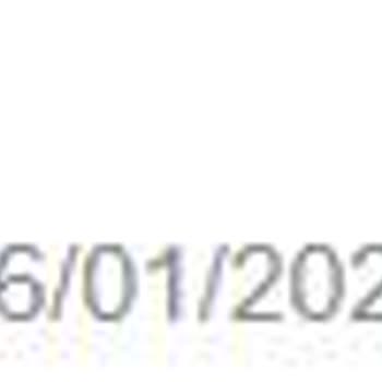 SGK Mantıksız Maaş Ödemeleri