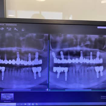 DentaCenter'den Şikayetçiyim
