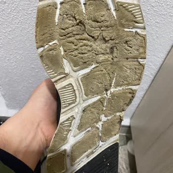 Skechers Does Not Care About Its Customers