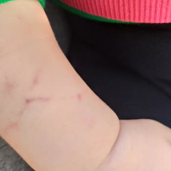 Özel Neon Hastanesi Acil İn Bebek Hemşire Eksikliği