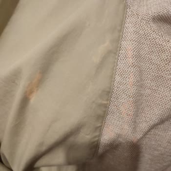 Vanish Kosla Leke Çıkarıcı Değil Ağartıcı