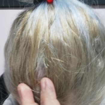 Palette Ürünü Saçımda Yaralara Neden Oldu