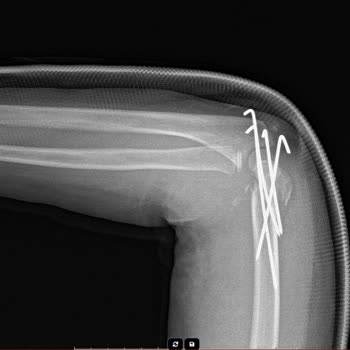 İstinye Üniversitesi Hastanesi Acımıyor