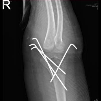 İstinye Üniversitesi Hastanesi Acımıyor