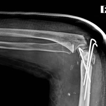 İstinye Üniversitesi Hastanesi Acımıyor