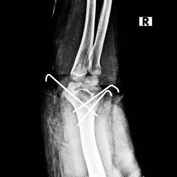 İstinye Üniversitesi Hastanesi Acımıyor