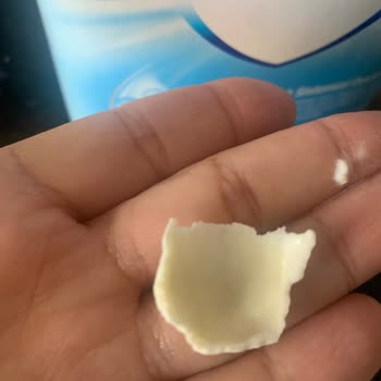 Milupa Aptamil Mamadan Kurumuş Taş Gibi Bir Şey Çıktı