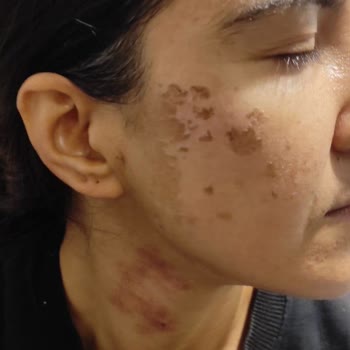 Anatolia Güzellik Merkezi'nin Yaşattığı Sorun