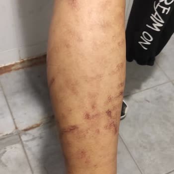 Anatolia Güzellik Merkezi'nin Yaşattığı Sorun