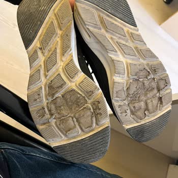 Skechers Eriyen Taban Ayakkabısını Kullanıcı Hatası Olarak Görüyor
