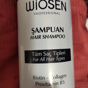 Wiosen Kozmetik Kaşıntı Ve Acayip Dökülme Yaptı