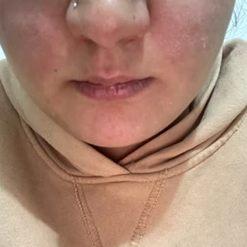 Yves Rocher Kremi Yüzümü Tahriş Etti