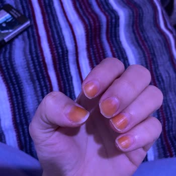 Flormar Tırnaklarım Turuncu Oldu