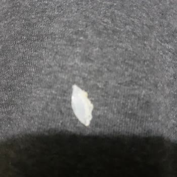 Pınar Et ve Süt Peynirli Kroketten Plastik Parçası Çıkması Şikayeti