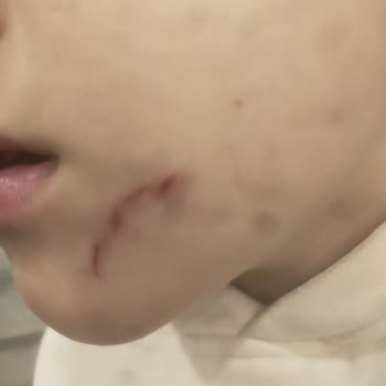 Duysev Anaokulları Çocuğuma Şiddet, Öğretmen İhlali