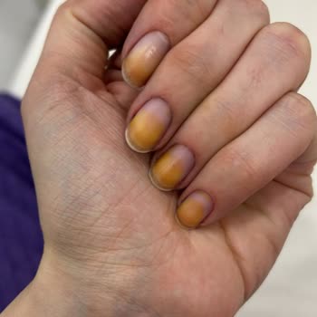 Flormar 321 Numaralı Oje Tırnakları Turunculaştırdı