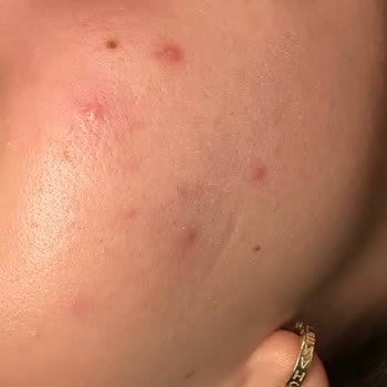 Kiperin Collagen KİPER'in COLLAGEN'i Sipariş Etmeyin!