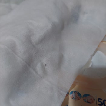 Molfix Yenidoğan Islak Mendil Siyah Leke