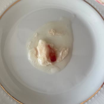 Türe Yumurtada Kan Çıktı