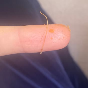 Lays Paketten Çıkan Kıl/İp