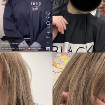 Alp Eren Güder Kuaför Saçlarım 5 Renk Ve Kafa Derim Soyuldu