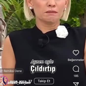 Honor 90 Da Ekrandaki 2harf Kesik Görünüyor