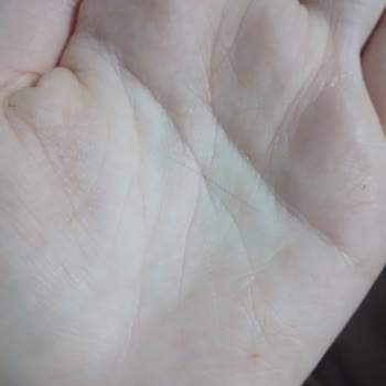 Dardanel Sushida Kıl Sorunu