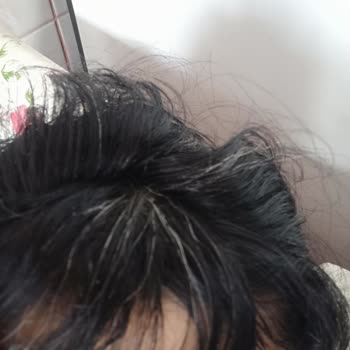 Urban Care Saç Toniği Saçlarımı Beyazlattı