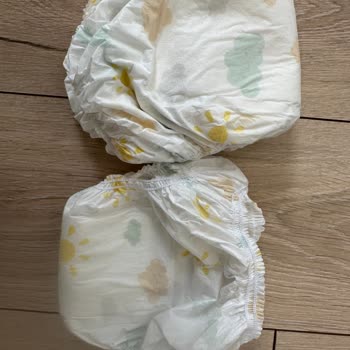 Baby Mall Sevi Bebe Alıştırma Külodu Alerji Yaptı