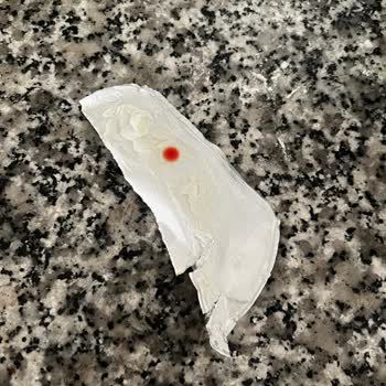 Sütaş Süzme Yoğurt Ambalajında Leke