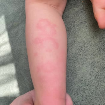 Abdi İbrahim Grintuss Pediatrik Şurup Alerji