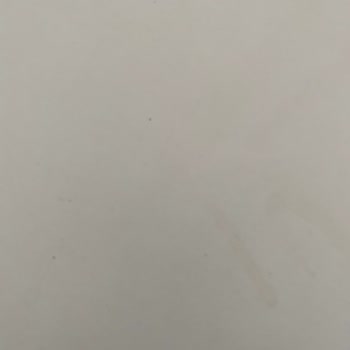 Bupa Acıbadem Sigorta Bupa Acıbadem Müşteri Hizmetleri Ve Setcard Uygulaması Sorunlu