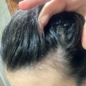 Urban Care Urban Marka Saç Şampuan Ve Toniği Kepek Yapıyor