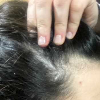 Urban Care Urban Marka Saç Şampuan Ve Toniği Kepek Yapıyor