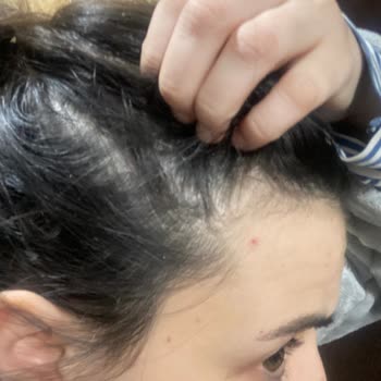 Urban Care Urban Marka Saç Şampuan Ve Toniği Kepek Yapıyor