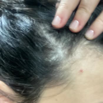 Urban Care Urban Marka Saç Şampuan Ve Toniği Kepek Yapıyor