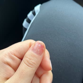 Unicorn Nail Bar'dan Tırnağım Enfeksiyon Kaptı