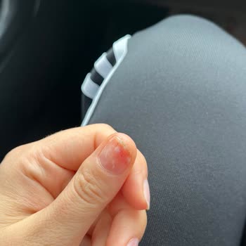 Unicorn Nail Bar'dan Tırnağım Enfeksiyon Kaptı