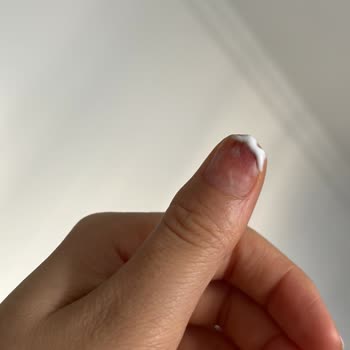 Unicorn Nail Bar'dan Tırnağım Enfeksiyon Kaptı