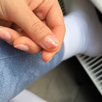 Unicorn Nail Bar'dan Tırnağım Enfeksiyon Kaptı