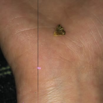 Piyale Makarnadan Ne Olduğu Belli Olmayan Tırnağa Benzeyen Bir Cisim Çıktı