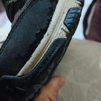 Skechers Hiçbir Kusuru Üstlenmiyor