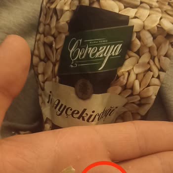 Çerezya İç Ayçekirdeğinin İçinden Boncuk Çıkması