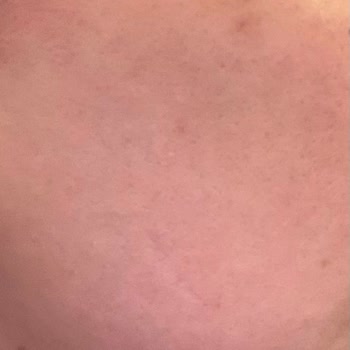 Turkeyana Clinic Ataköy Cildimi Mahvetti