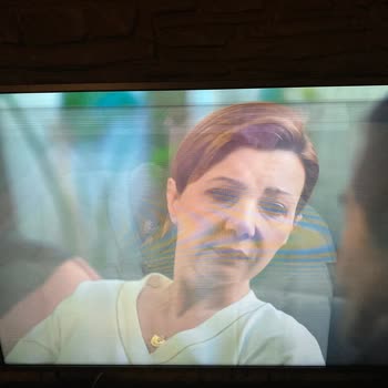 Philips TV Ekran Kayması Sorunu