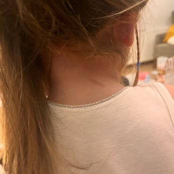 Mey Kuaför 4 Yaşındaki Kızımı Fön Çekerken Yaktılar.