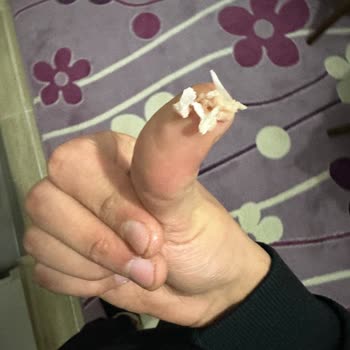 Derya Ton Balığı İçerisinde Çıkan Kılçık Evde Kemik Parçası