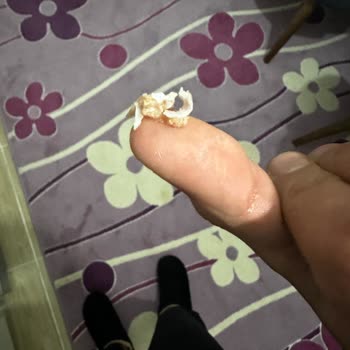 Derya Ton Balığı İçerisinde Çıkan Kılçık Evde Kemik Parçası